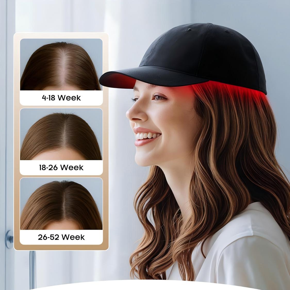 Morfone 56 LED infrared therapy cap. A portable red light therapy cap featuring three wavelengths—630nm, 850nm, and 940nm—to promote hair growth
