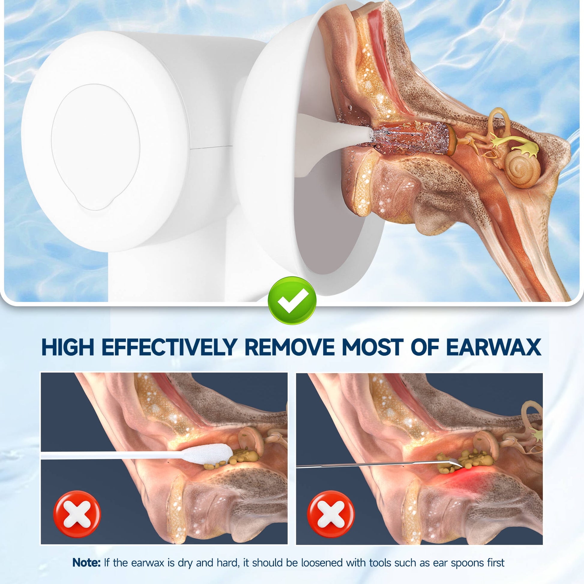 Morfone Upgraded Ear Wax Removal, 2 in 1 Cleaning & Drying Ear Cleaner, Effective Ear Cleaning Kit with One-Piece Waste Tank, Safe Ear Irrigation with 5 Pressure Settings, IPX7