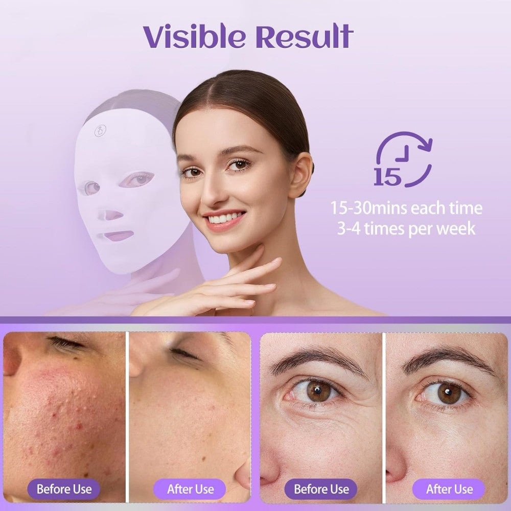 Morfone 7-Color Wireless Red Light Therapy Mask Home Skincare Beauty Device Holiday Gift