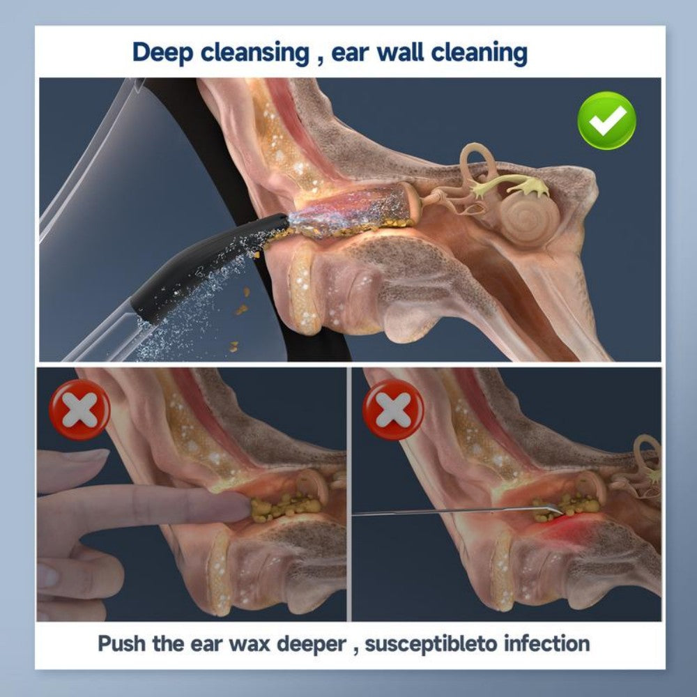 Morfone 4 Modes Electric Ear Cleaner with 5 Nozzles Ear Cleaner Ear Cleaning Kit Ear