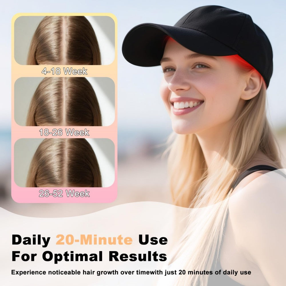 Morfone 56 LED infrared therapy cap. A portable red light therapy cap featuring three wavelengths—630nm, 850nm, and 940nm—to promote hair growth