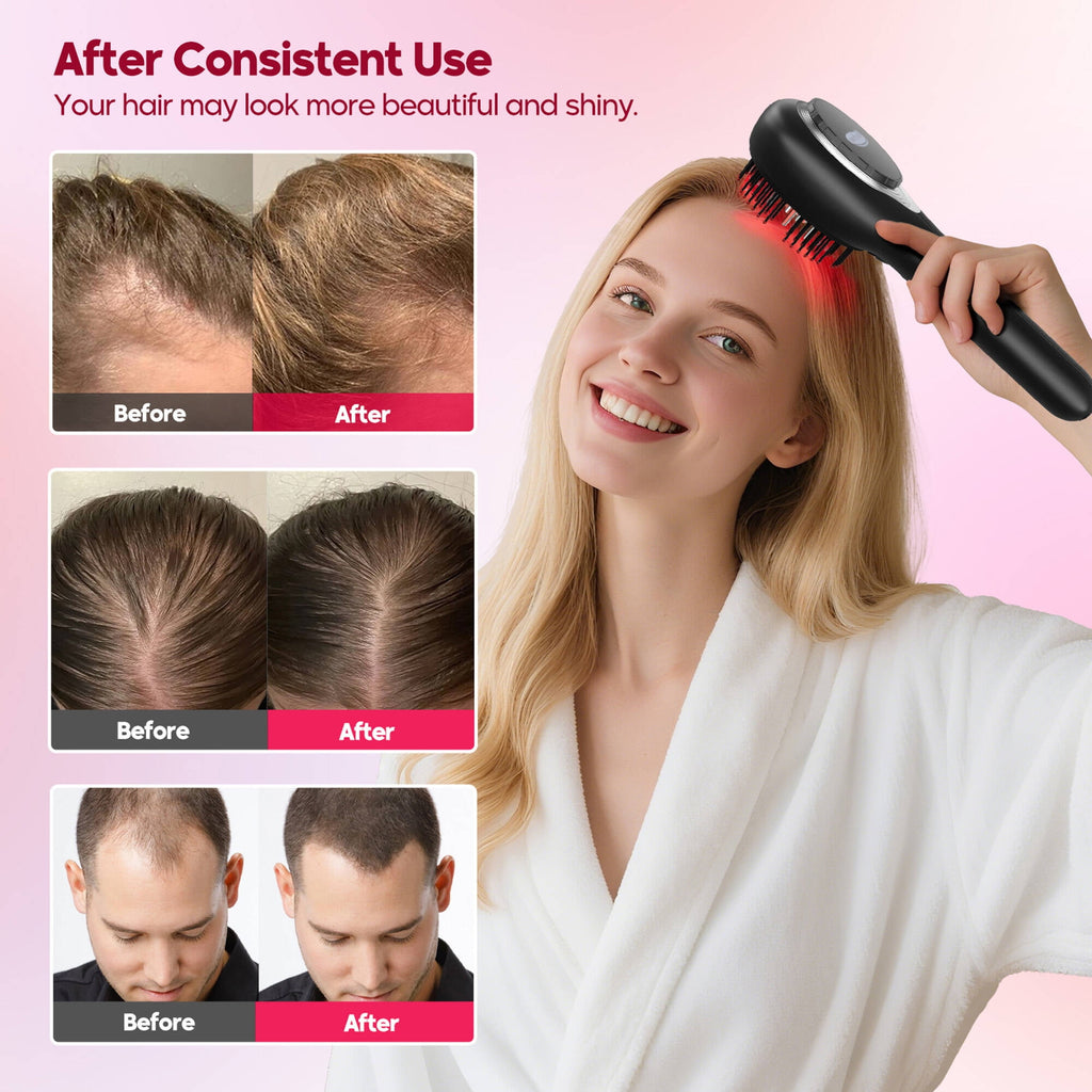 Morfone 3-in-1 Hair Oil Applicator, Electric Scalp Massager Brushes with Nano Mist Sprayer, 4 Massage Modes, Cordless Portable Hair Massager Comb for Men Women