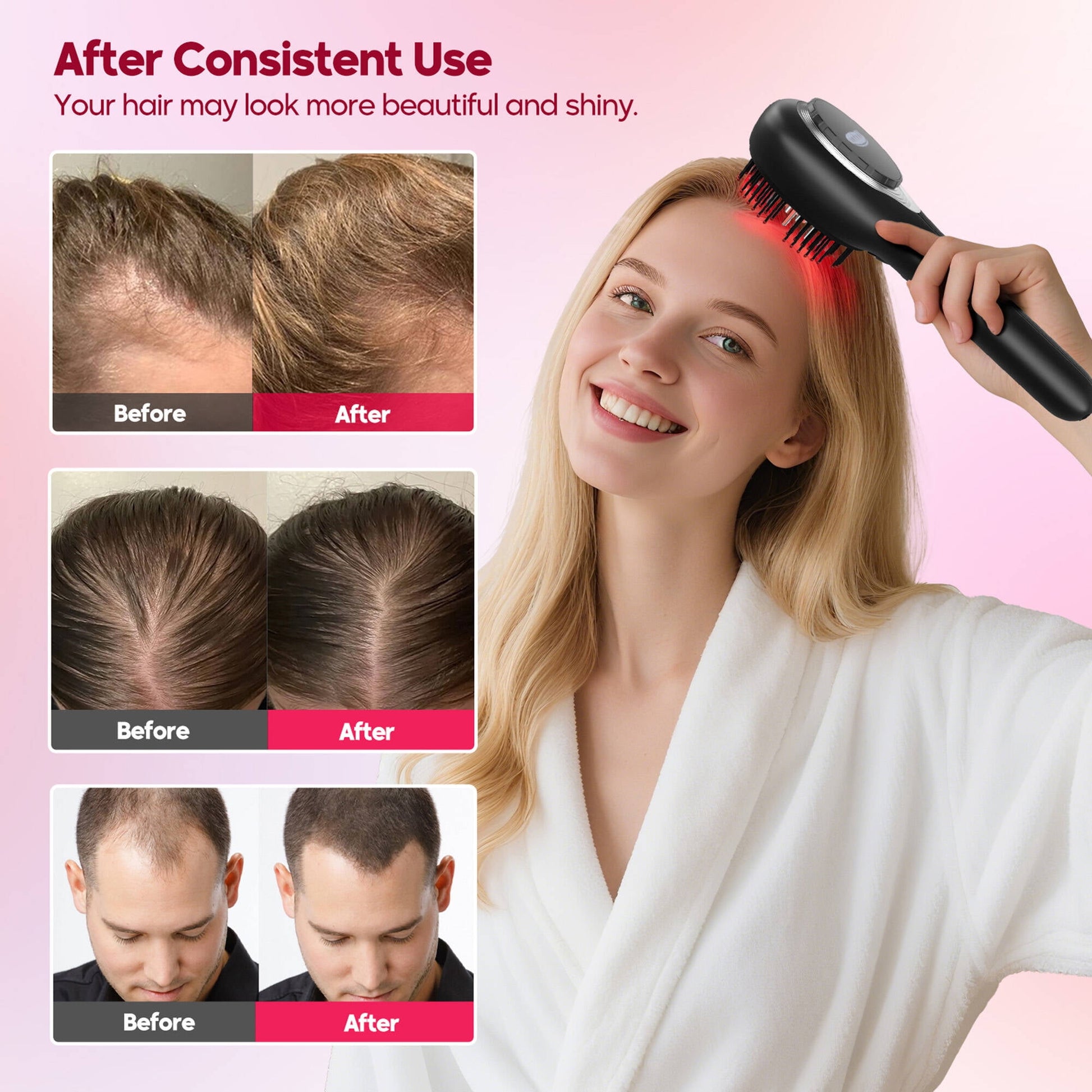 Morfone 3-in-1 Hair Oil Applicator, Electric Scalp Massager Brushes with Nano Mist Sprayer, 4 Massage Modes, Cordless Portable Hair Massager Comb for Men Women