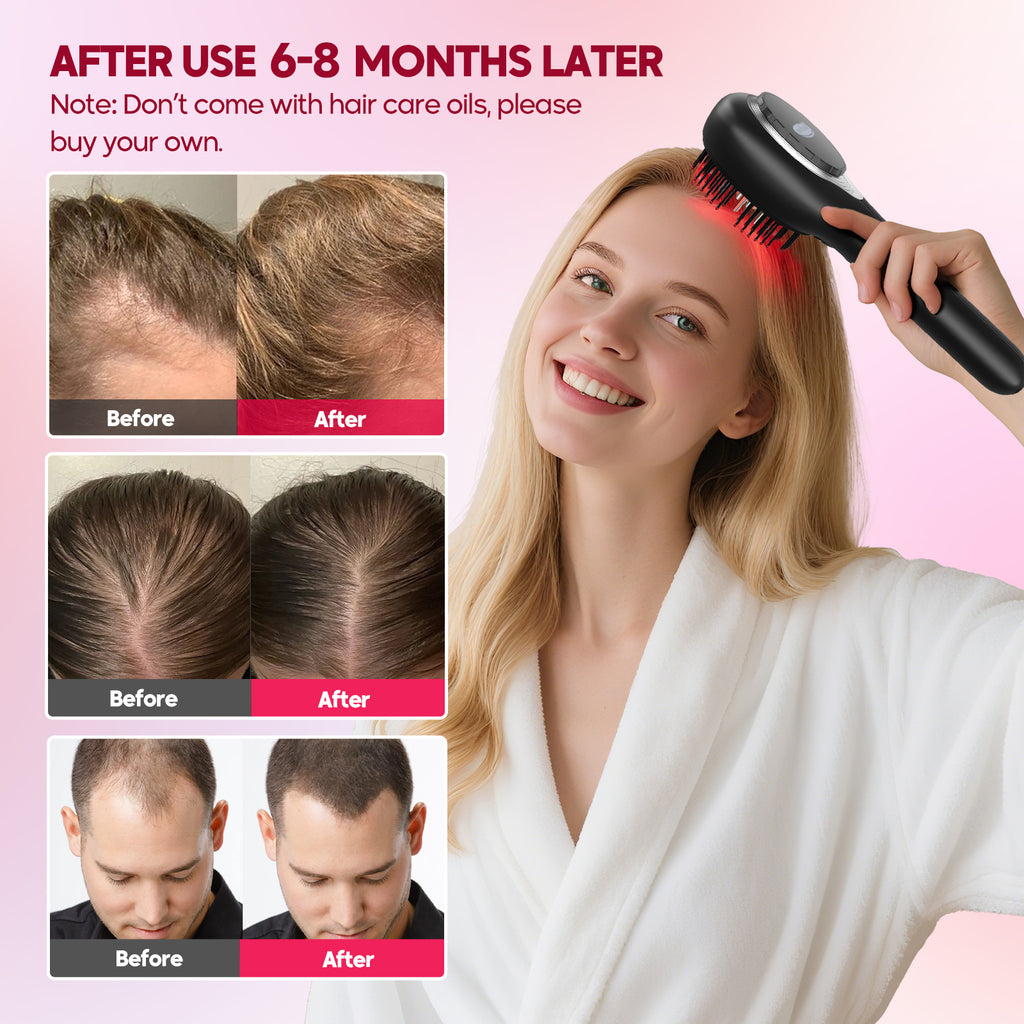 Morfone scalp massager and liquid applicator with red light electric scalp massage comb. 6 EMS roller balls + 650nm red light massage comb.
