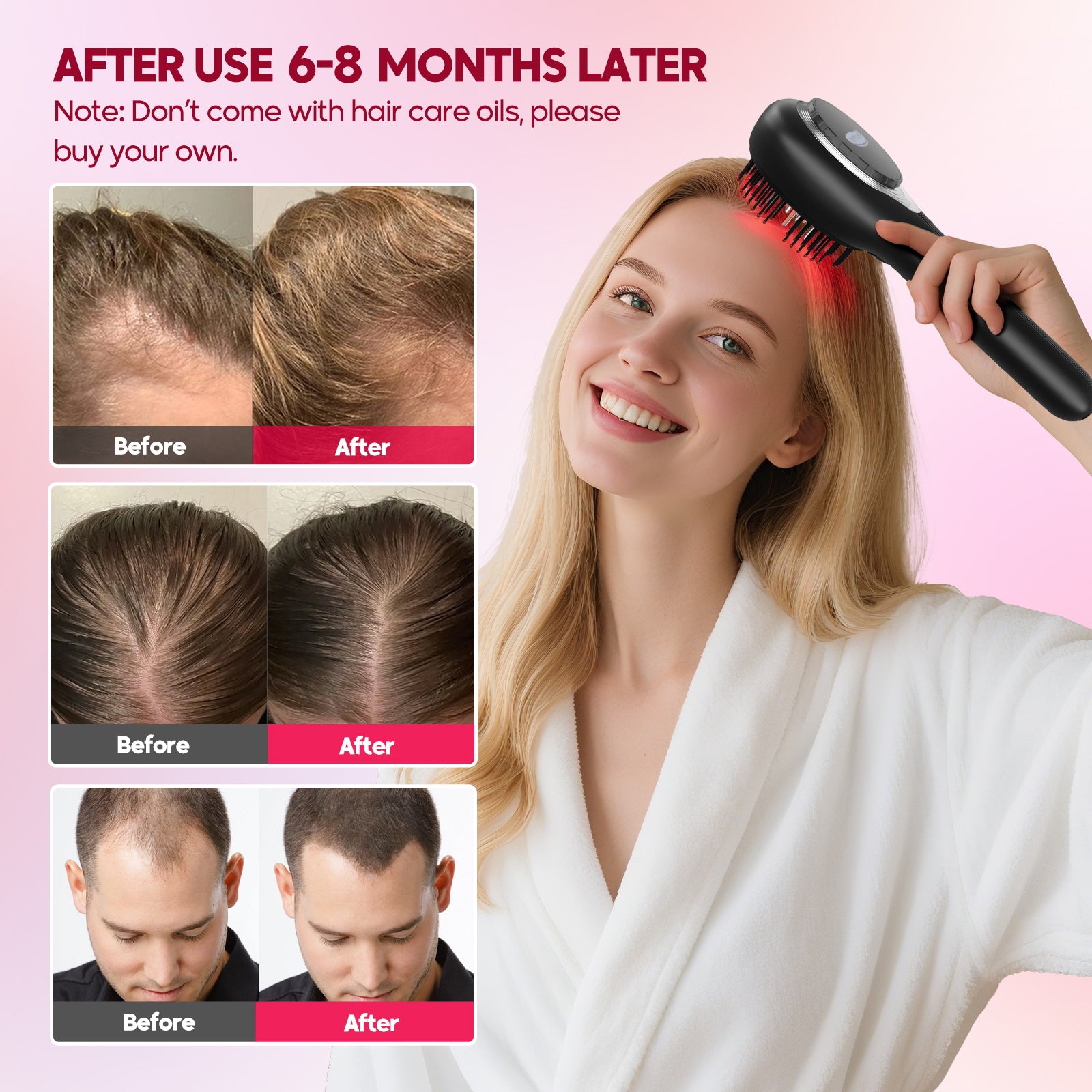 Morfone scalp massager and liquid applicator with red light electric scalp massage comb. 6 EMS roller balls + 650nm red light massage comb.
