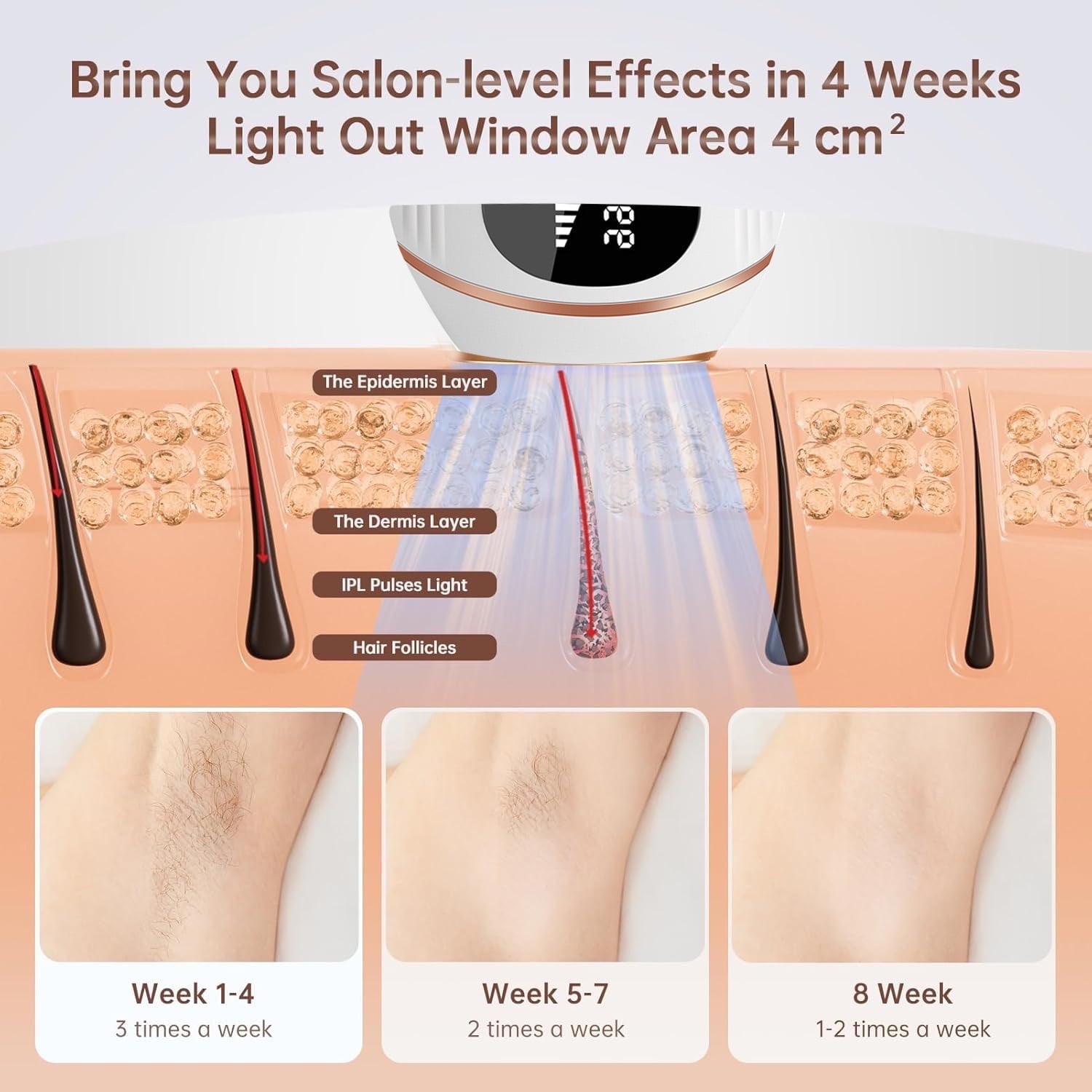 Morfone IPL Hair Removal, Laser Hair Removal Permanent for Women and Men, 999999 Flashes at Home Hair Removal Device for Facial Legs Arms Whole Body Treatment